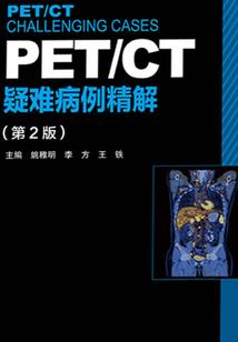一见倾心：斯人若彩虹